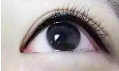 双眼皮埋线三天可以化妆吗(什么是双眼皮埋线？)