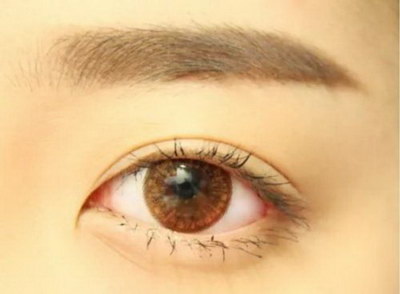 眼底出血后眼前黑影在慢慢变淡(眼底出血后眼前出现大量黑线)