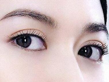 怎样才可以变双眼皮