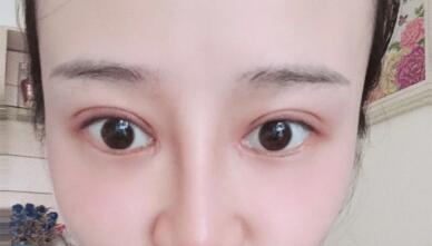 宝宝下眼袋特别明显的大(四岁宝宝眼袋特别明显)