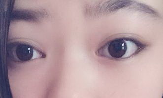 为什么一累眼袋就大_为什么眼睛下面有眼袋纹