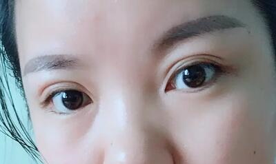 为什么眼角突然长了很多斑
