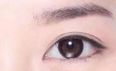 怀孕后眼睛周围长斑(怀孕为什么只有眼睛周围长斑)