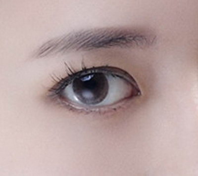 眼袋内切术后眼睛什么时候能沾水(眼袋内切手术后眼睛流血)