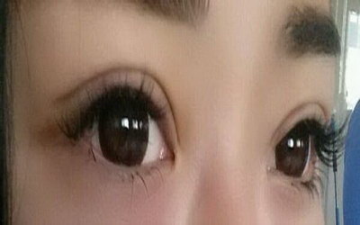 怎么快速消掉熬夜的黑眼圈