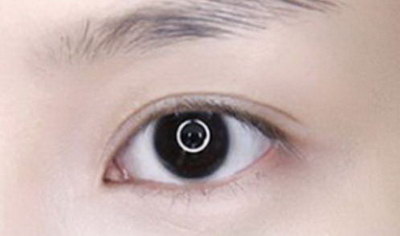 埋线双眼皮多久可以吃鸡蛋(做完埋线双眼皮多久可以吃鸡蛋)