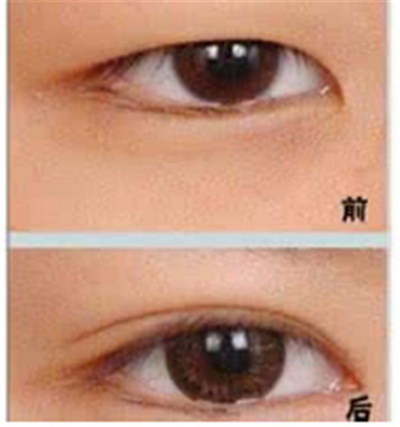 rafa眼部美容用法