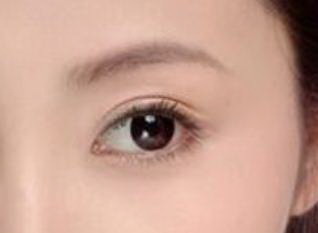 开双眼皮手术要价格(最好的双眼皮手术价格)