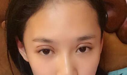 秦皇岛巧致美容医院吸脂怎么样(秦皇岛巧致双眼皮怎么样)