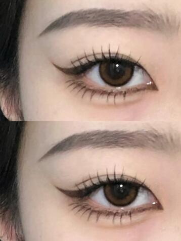 双眼皮拆线几天可以用美皮护