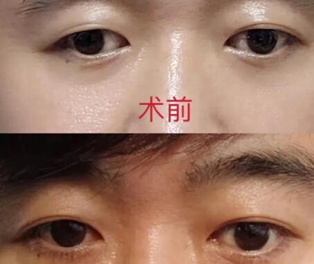 眼线怎么画才简单又好看_纹眼线多长时间能补色
