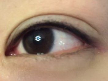 眼部蛋白线刚做完可以敷医用面膜_淡化眼部皱纹的护肤品