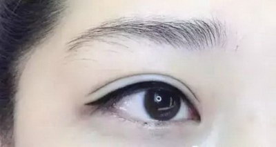 女人眼睛凹陷好不好_喝什么能提升眼睛视力