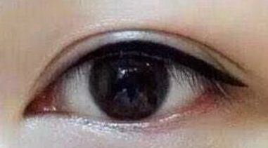 大眼睛割双眼皮好看吗(小眼睛割双眼皮好看吗)