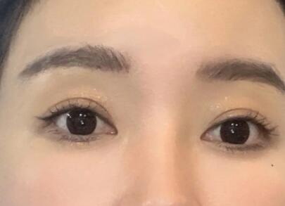 眼下有黑眼圈是什么病的预兆(眼下有黑眼圈细纹用什么眼霜)