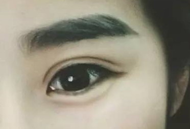眼纹怎么除去最安全有效(怎么除去眼角眼纹)