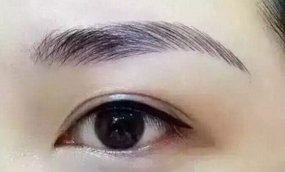 埋线双眼皮可以摸到线