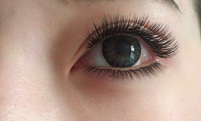 黑眼圈长期存在怎么办