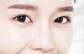 眼皮松弛适合做埋线双眼皮_眼皮松弛下垂适合做埋线双眼皮吗