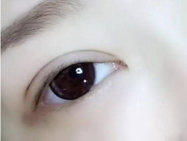 眼袋要怎么内调消除最快