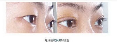 为什么早上起来右眼睛肿了(为什么早上起来左眼睛肿)
