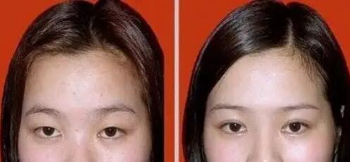 眼部动脉硬化能治好吗(眼部动脉硬化的病因)