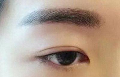 有黑眼圈怎么办怎么去除中学生_眼部皱纹黑眼圈怎么去除最有效果