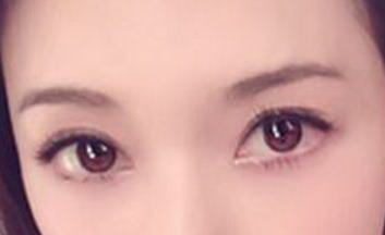 做完眼袋手术20天了刀口还红怎么办(眼袋手术后刀口还红怎么办)