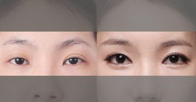 牙齿拍片需要张嘴吗「牙齿拍片需要闭眼吗」