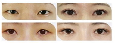 女人做美瞳线好不好_纹美瞳线第二次补色最佳时间
