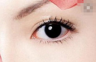 怎么消除黑眼圈眼袋小妙招(年轻人怎么消除黑眼圈眼袋)
