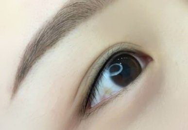 怎样去除黑眼圈眼袋的方法