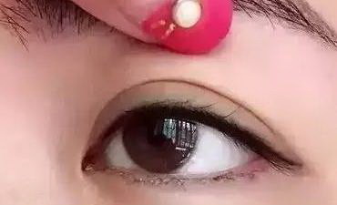 埋线双眼皮不对称怎么处理(埋线双眼皮不对称怎么微调)