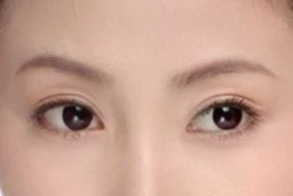 怎么消除男人的眼袋