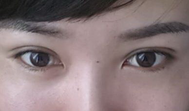延缓眼部衰老的方法