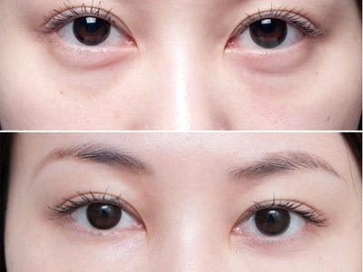 眼睛有黑眼圈怎么化眼影好看