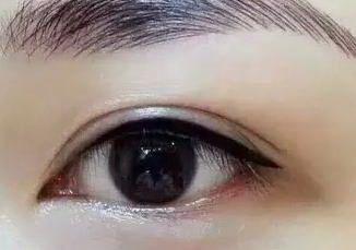 眼睛周围撞淤血了怎么办(眼睛周围撞淤血的处理方法)
