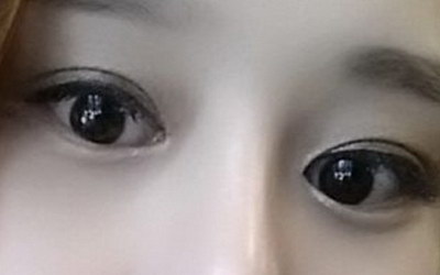 哪些情况适合做双眼皮(哪些情况适合割双眼皮)
