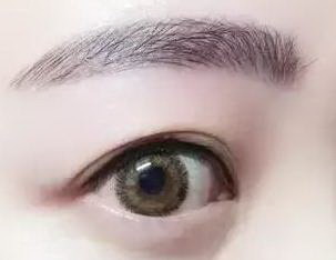 内双可以割双眼皮的手术吗
