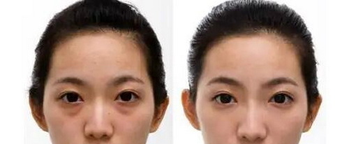 石家庄哪个医院眼科比较好(石家庄新视界眼科医院)