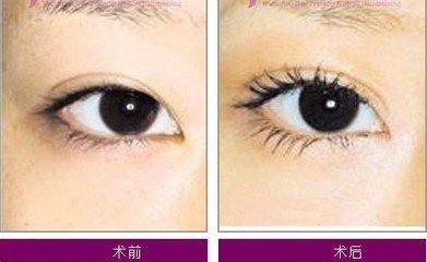 很深的眼线能洗掉吗