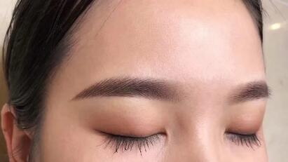 双眼皮两个月肉条明显还能消吗(双眼皮两个月肉条明显)