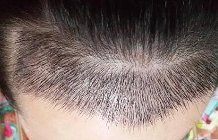 怎样可以让睫毛长出来【怎样可以让睫毛长长】