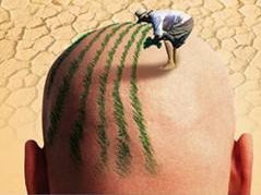 自然卷植发永久变直「自然卷植发永久变直多少钱」