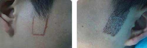 男士掉头发是什么原因引起的怎么调理(男士头顶掉头发是什么原因引起的)