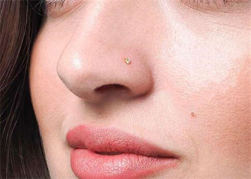 瞅一瞅新泰市酒糟鼻激光医院排行榜十强