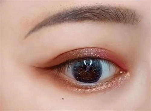 品读|邵武市不良重睑矫正有资质TOP7医院!邵武市不良重睑矫正哪个医院评价好?